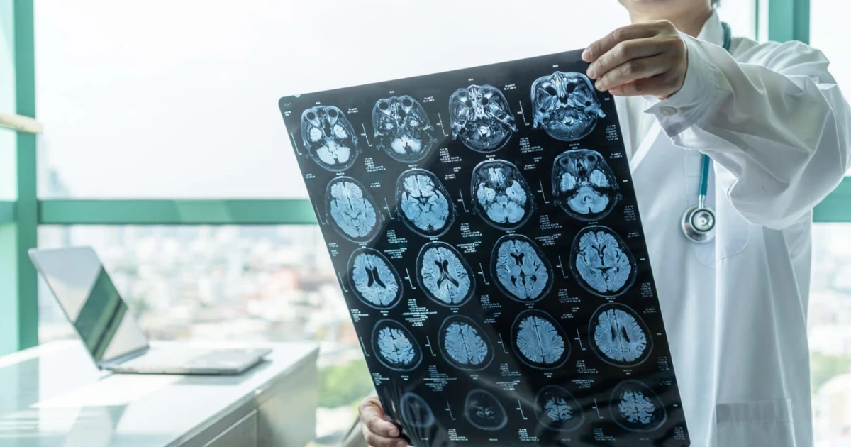 Abogado de Lesiones Cerebrales Traumáticas en Dallas
